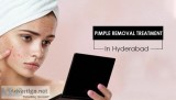 Pimple removal treatment in Hyderabad.