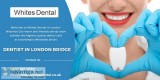 Othodontist London Bridge