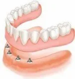 Teeth Whitening Dentist at Pembridge Dental