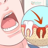 Dental Implant Dentistry