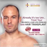 Treat your baldness and hair loss with hair transplant