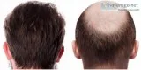 About satya hair clinic - hair transplant doctors in delhi