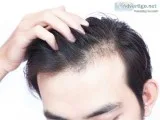 Hair thinning treatment delhi- satya skin & hair clinic