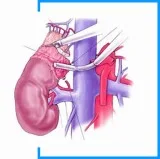 Intra-abdominal laparoscopic surgeries