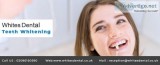 Instant Teeth Whitening