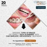 Dental braces treatment cost in Hyderabad - orthodontist in Hyde
