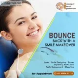 smile designing cost in Hyderabad - dental clinic in Hyderabad