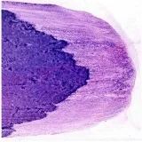 Cytology Slides