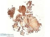 Virtual IHC slides