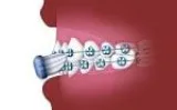 Orthodontist Macomb MI