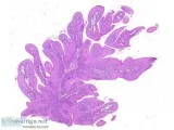 Oral pathology quiz