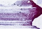 Histopathology slides