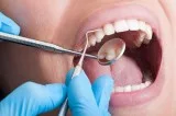 Dental cleaning and X rays NO INSURANCE NEEDED. (Garden Grove Co