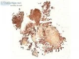 Virtual IHC slides