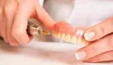 Dentist Ferny Hills  Denture Square