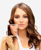 Where Can You Get the Best Acne Scar Treatment