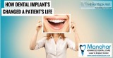 Best implant specialist in vizag
