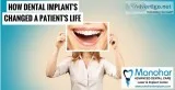 Best implant specialist in vizag