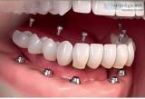 Manohar dental care in vizag