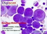 Cytology Slides