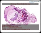 Histopathology slides