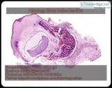 Histopathology slides