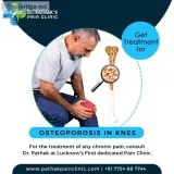 Knee pain doctor  Knee pain doctor in Lucknow