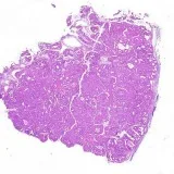 Online Pathology quiz cases
