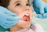 Dental Implants in Waterloo