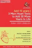 Heart attack not a sudden response but gradual response