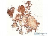 Virtual IHC slides