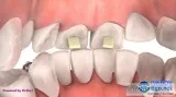 Best pediatric orthodontist near me
