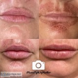 LipFlip PlasmaTight_byHeathe r