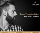 Why Should You Opt for Beard Hair Transplant