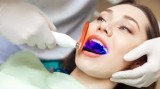 Zoom teeth whitening in clute texas