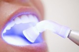 Dental clinic for kids in madurai
