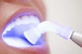 Dental clinic for kids in madurai