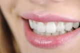 Tooth replacement options for missing teeth
