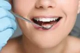 Dental bone graft treatment