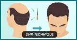 Best Hair Transplant Clinic in Delhi