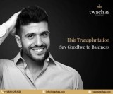 Where to Visit for the Best Hair Transplant in Faridabad