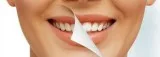 Best Porcelain Veneers in Hobart
