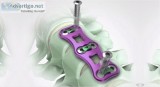 Spine implants for back pain surgery