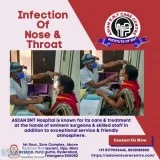 Dr. Chava Anjaneyulu  Best ENT Doctor in Hyderabad  Asian ENT Ca
