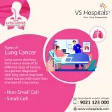 Chennai cancer hospital