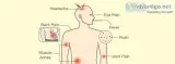 Malaria Malady Causes and Symptoms of Malaria and Tips to Tackle