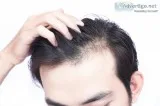 Hair Loss Treatment