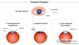 Glaucoma Specialist in Mumbai