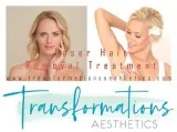 Get Hassle-Free Laser Hair Removal Treatment at Transformations 