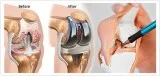 We have the best orthopedic doctor in jaipur